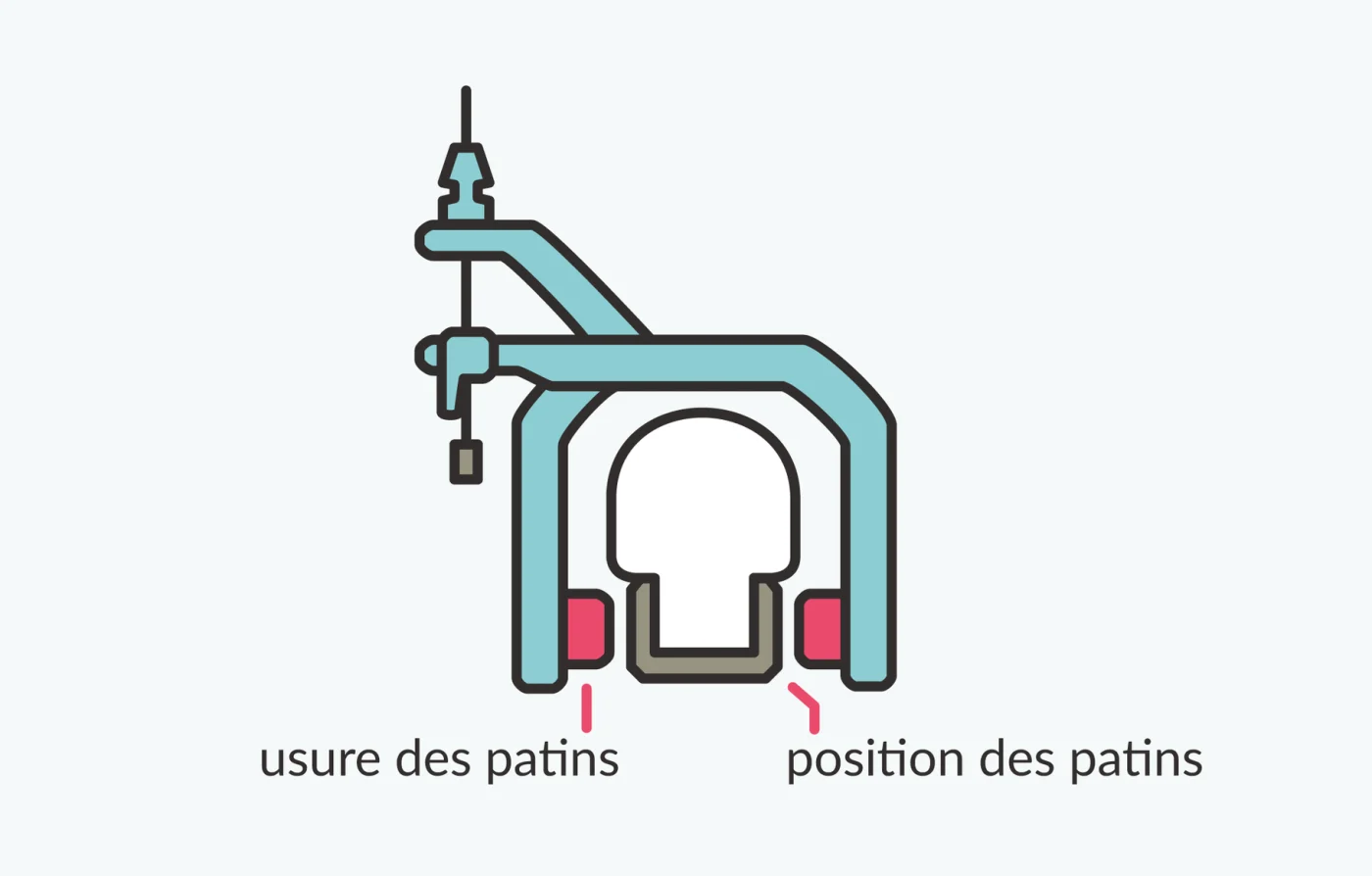 Un étrier de frein sur une jante, avec deux repères : l'usure des patins et leur position par rapport à la jante.